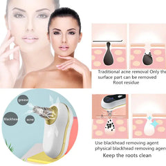 Vacuum Suction Clean Skin Care Beauty Machine